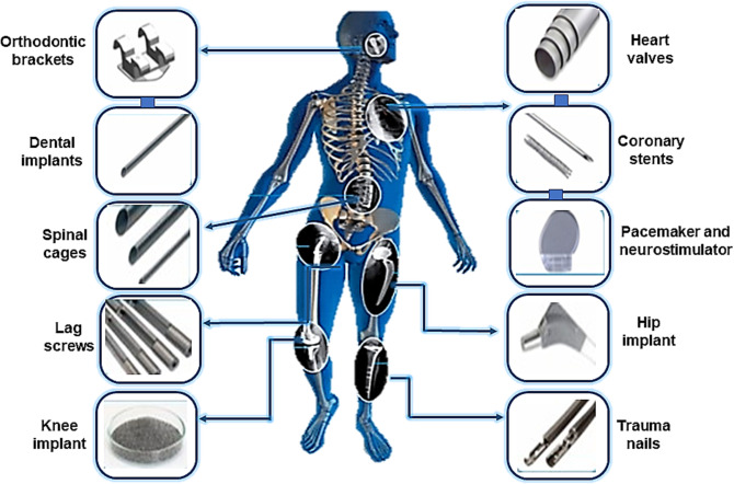 Il Nitinol aiuta l'organismo