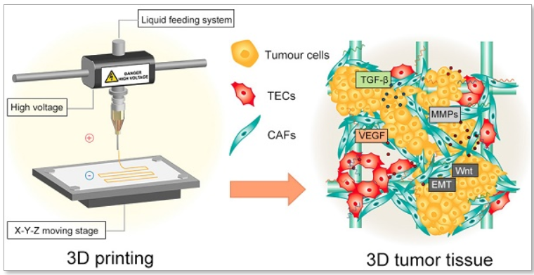 L'impression 3D dans le traitement du cancer